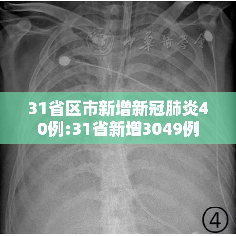 31省区市新增新冠肺炎40例:31省新增3049例
