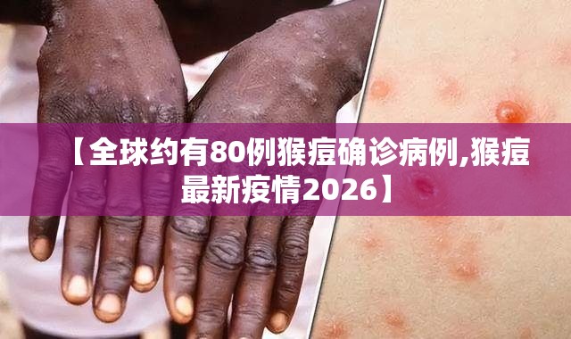 【全球约有80例猴痘确诊病例,猴痘最新疫情2026】 【全球约有80例猴痘确诊病例,猴痘最新疫情2026】