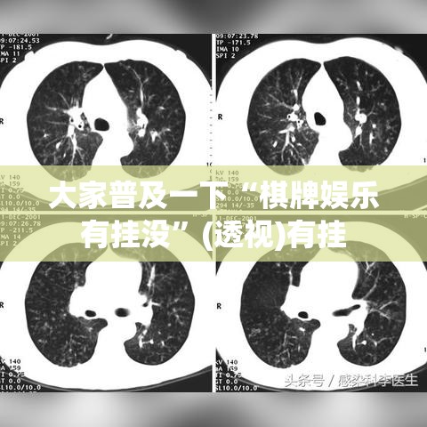 大家普及一下“棋牌娱乐有挂没”(透视)有挂