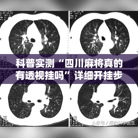 科普实测“四川麻将真的有透视挂吗	”详细开挂步骤